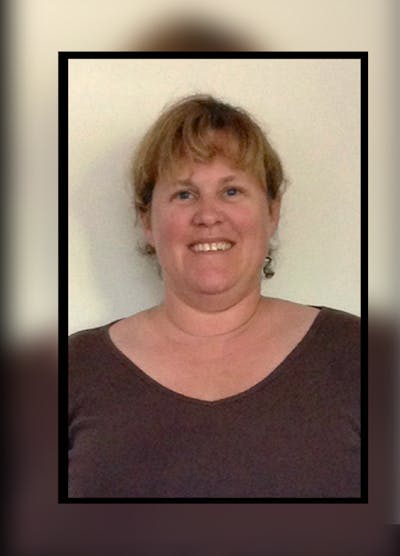 Patients 40-59 Years Old Before & After Gallery - Patient 14494542 - Image 1