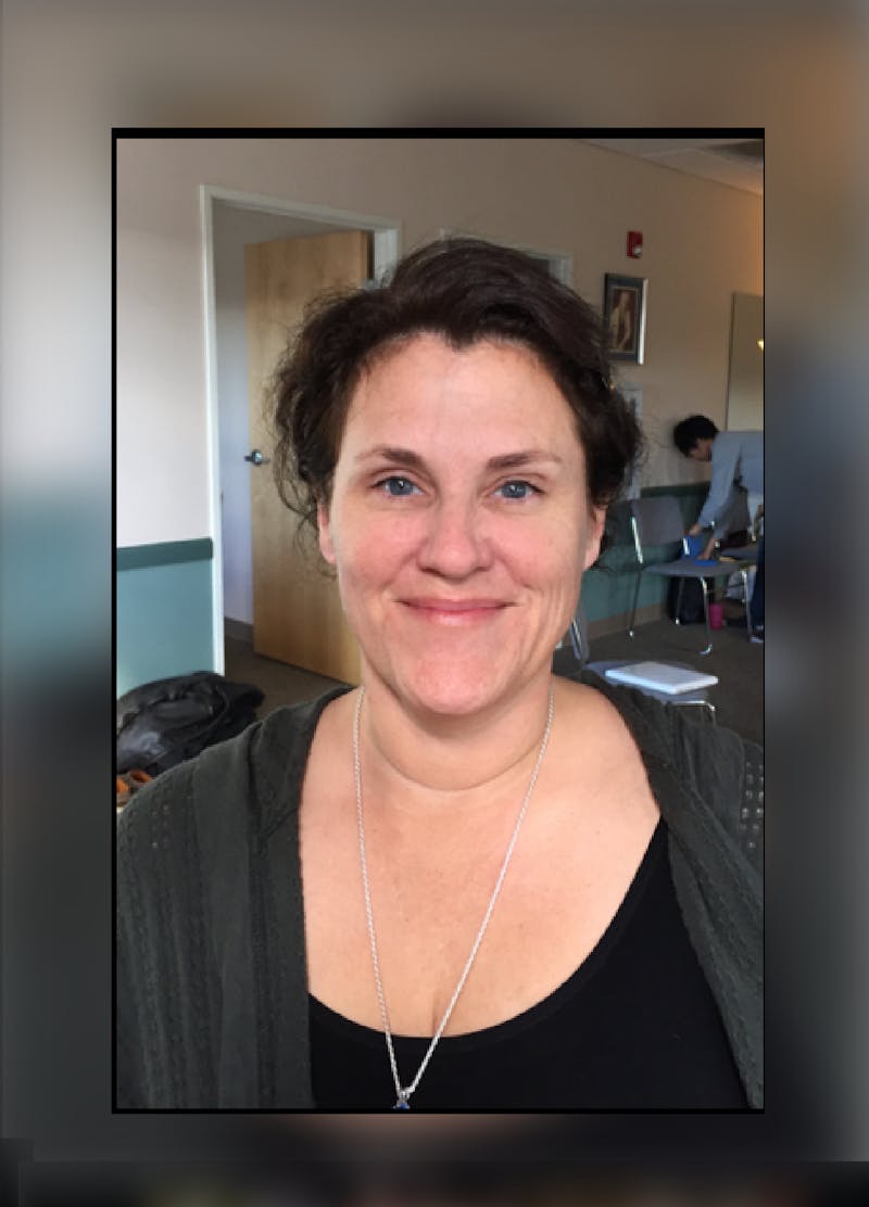 Patients 40-59 Years Old Before & After Gallery - Patient 14494542 - Image 2