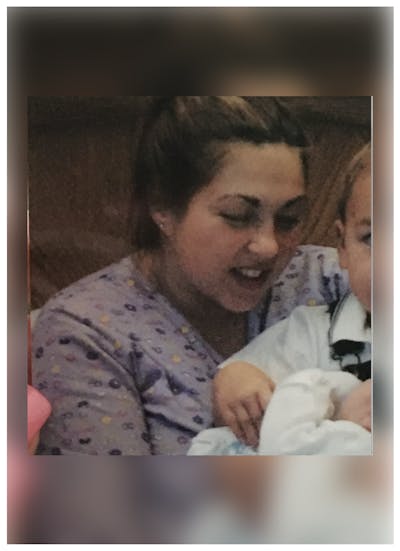 Patients 40-59 Years Old Before & After Gallery - Patient 14494545 - Image 1