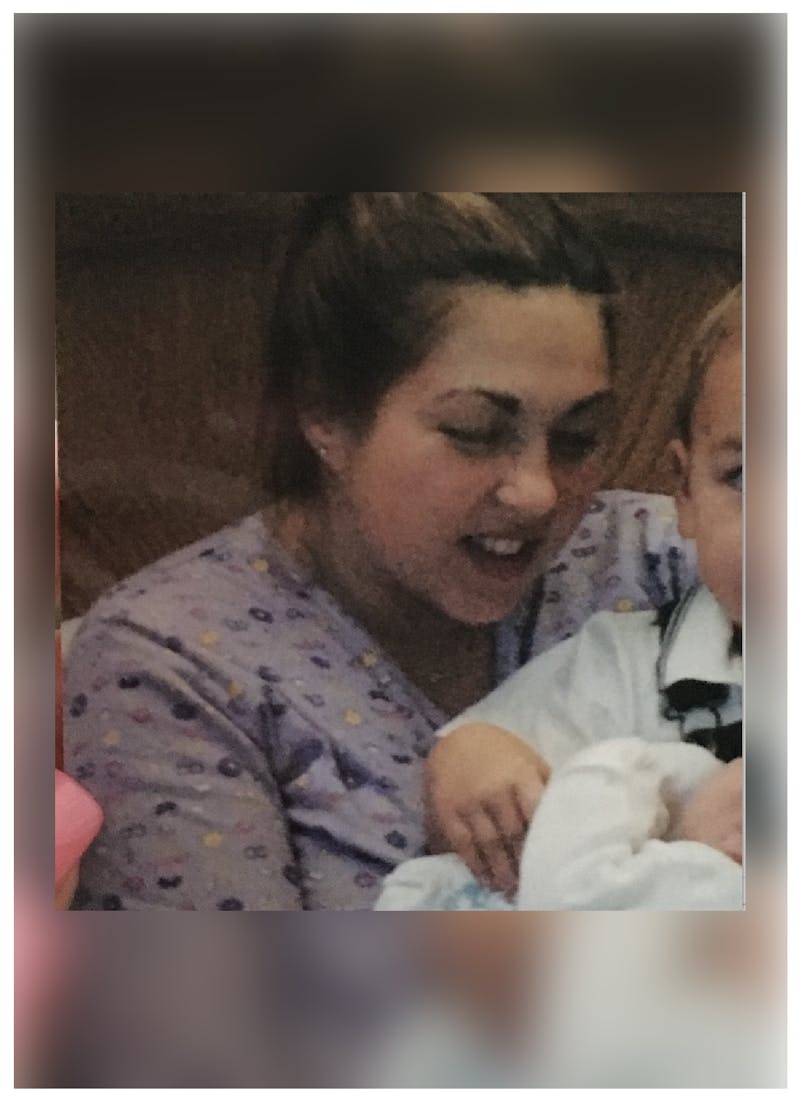 Patients 40-59 Years Old Before & After Gallery - Patient 14494545 - Image 1