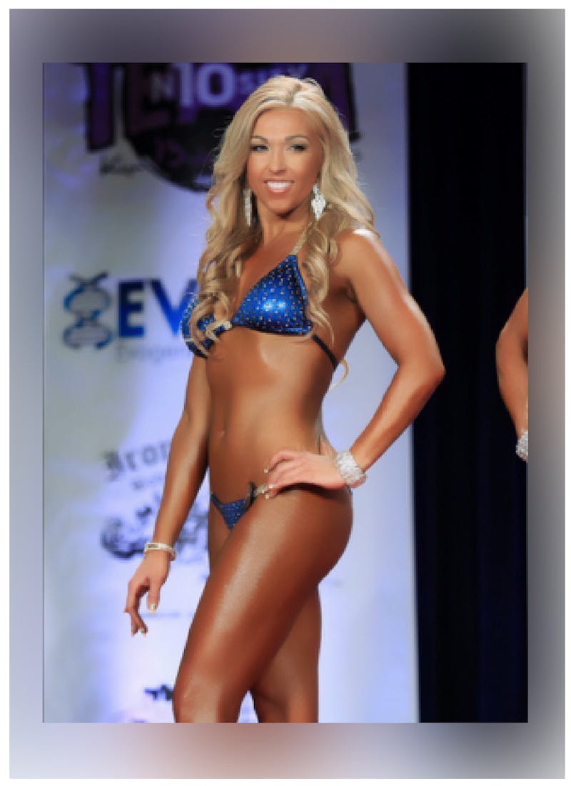 Patients 40-59 Years Old Before & After Gallery - Patient 14494545 - Image 2