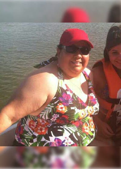 Patients 40-59 Years Old Before & After Gallery - Patient 14494546 - Image 1