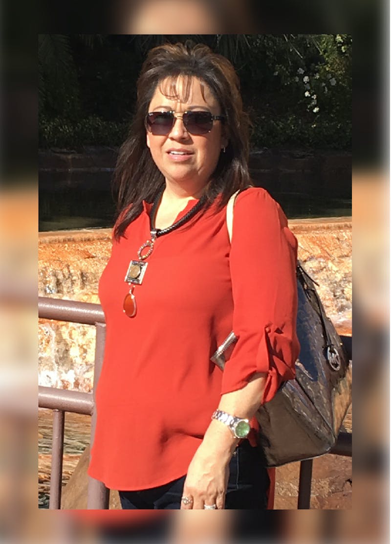 Patients 40-59 Years Old Before & After Gallery - Patient 14494546 - Image 2