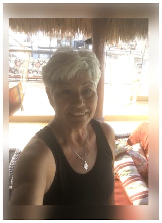 Patients 40-59 Years Old Before & After Gallery - Patient 14494547 - Image 2