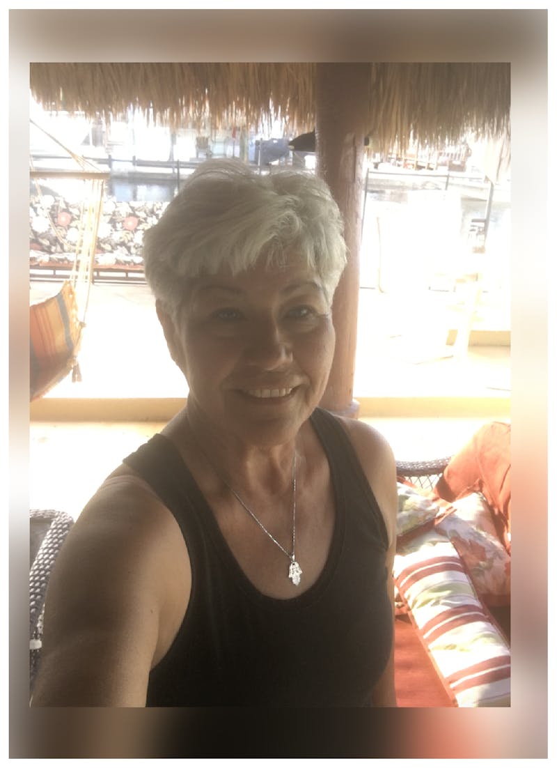 Patients 40-59 Years Old Before & After Gallery - Patient 14494547 - Image 2