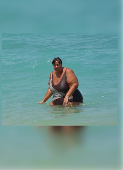 Patients 40-59 Years Old Before & After Gallery - Patient 14494550 - Image 1