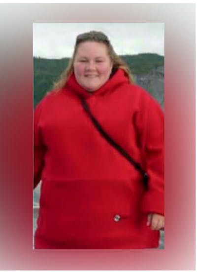 Patients 40-59 Years Old Before & After Gallery - Patient 14494551 - Image 1