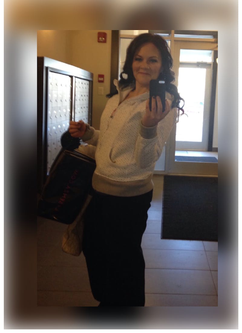 Patients 40-59 Years Old Before & After Gallery - Patient 14494551 - Image 2