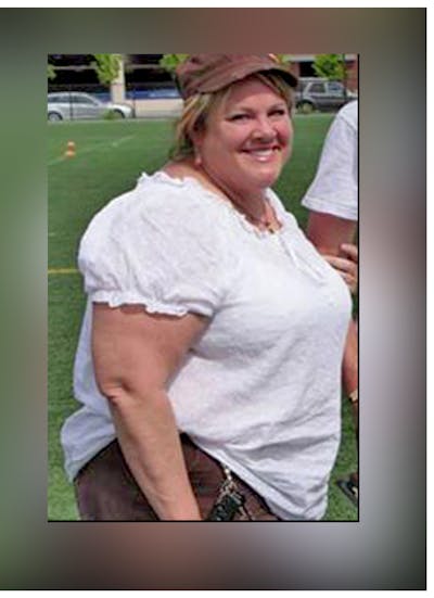 Patients 40-59 Years Old Before & After Gallery - Patient 14494556 - Image 1