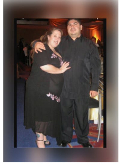 Patients 40-59 Years Old Before & After Gallery - Patient 14494559 - Image 1