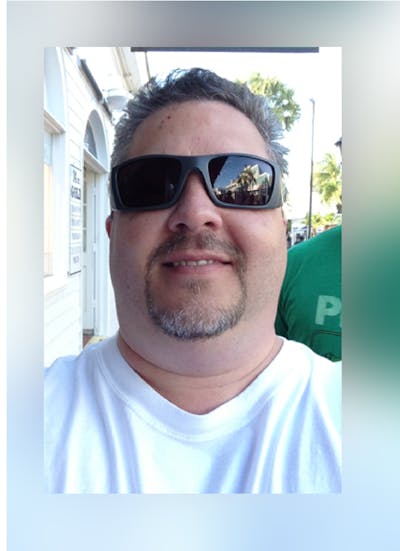 Patients 40-59 Years Old Before & After Gallery - Patient 14494562 - Image 1