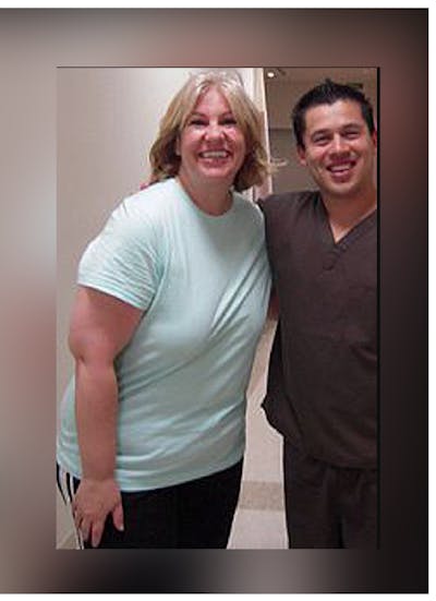 Patients 40-59 Years Old Before & After Gallery - Patient 14494563 - Image 1