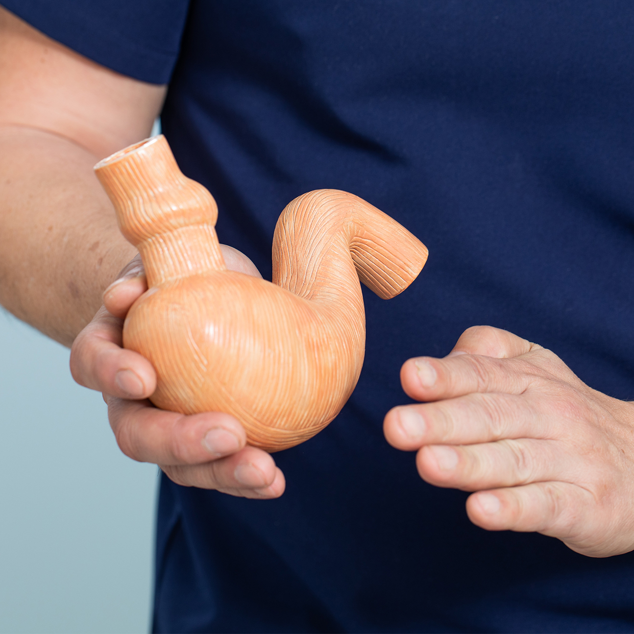 Lap Band to Gastric Sleeve Tijuana Lap Band to Gastric Sleeve Mexico