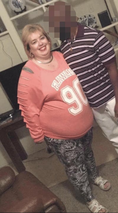 Patients 40-59 Years Old Before & After Gallery - Patient 23157876 - Image 1