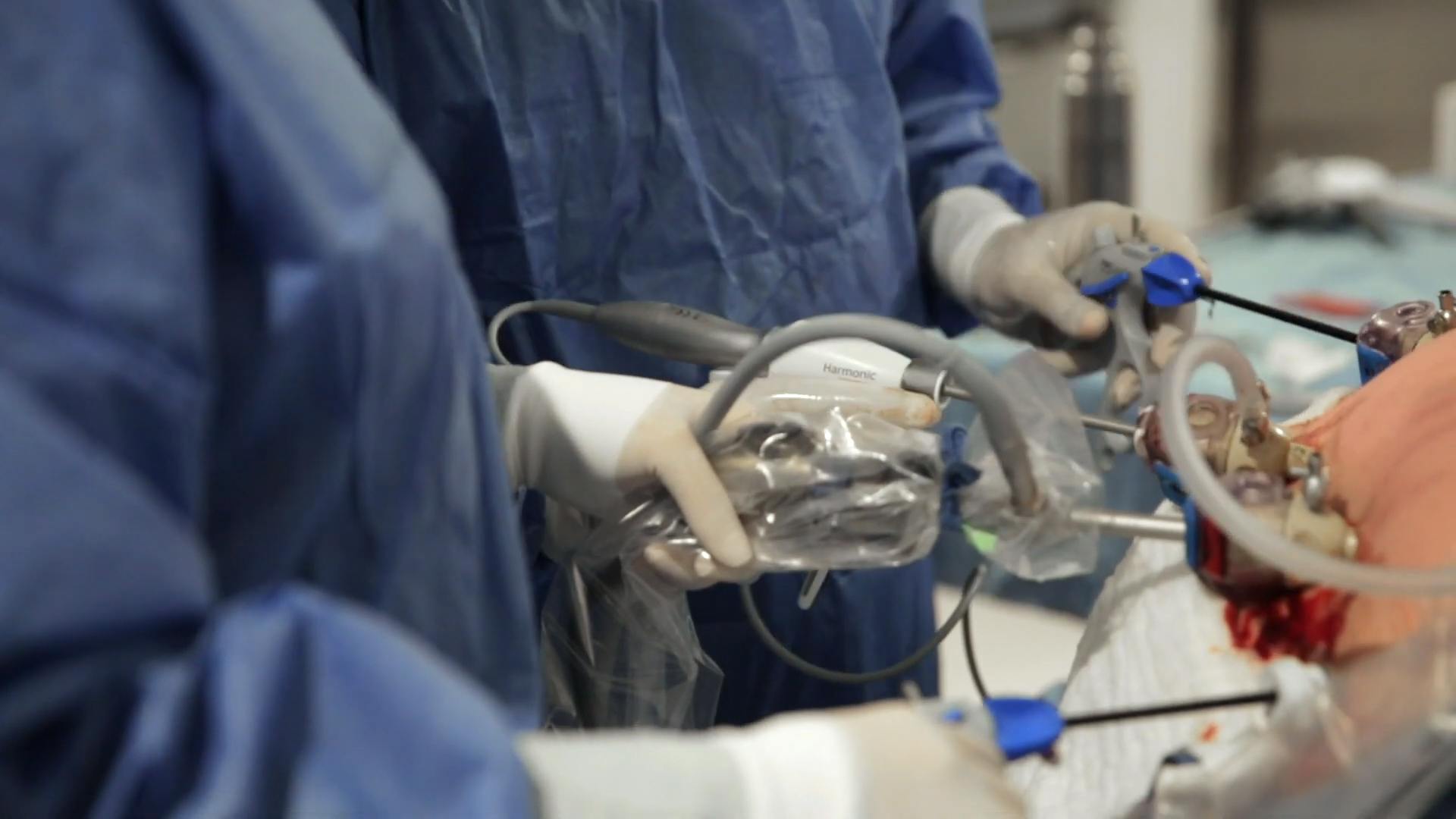 Doctors performing gastric sleeve surgery at Obesity Control Center in Tijiuana, Mexico