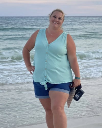 Patients 20-39 Years Old Before & After Gallery - Patient 37624584 - Image 1