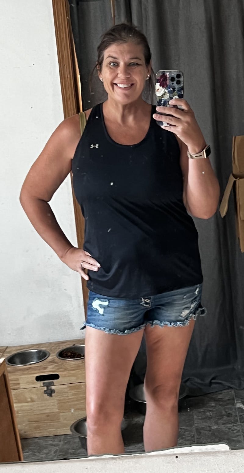 Patients 40-59 Years Old Before & After Gallery - Patient 44549163 - Image 2