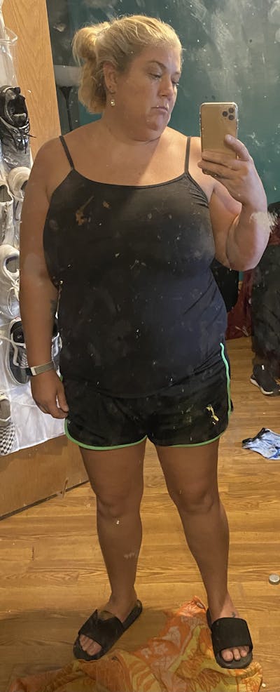 Patients 40-59 Years Old Before & After Gallery - Patient 44549163 - Image 1