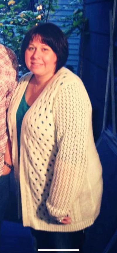 Patients 40-59 Years Old Before & After Gallery - Patient 44606904 - Image 1