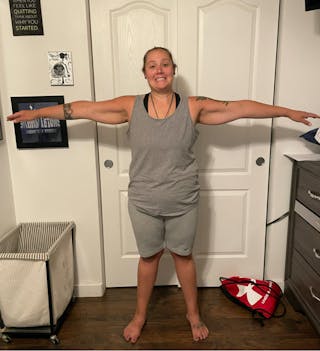 Patients 20-39 Years Old Before & After Gallery - Patient 51538348 - Image 2