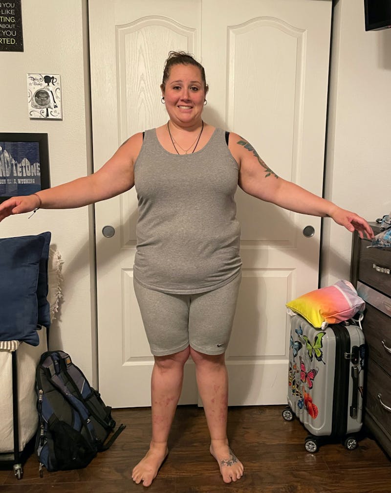 Patients 20-39 Years Old Before & After Gallery - Patient 51538348 - Image 1