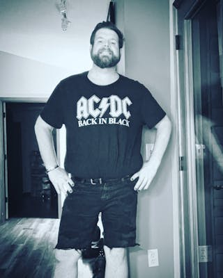 Patients 20-39 Years Old Before & After Gallery - Patient 51538642 - Image 2