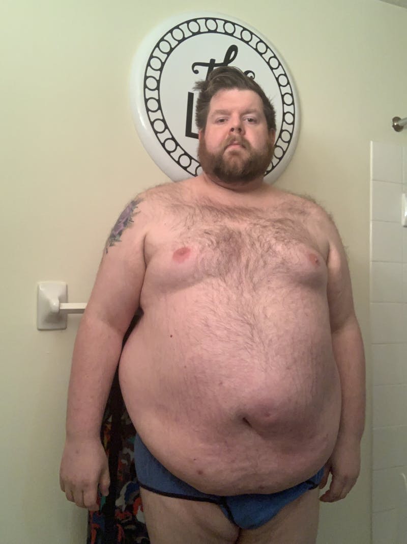 Patients 20-39 Years Old Before & After Gallery - Patient 51538642 - Image 1