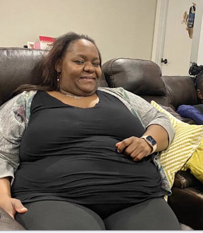 Patients 40-59 Years Old Before & After Gallery - Patient 51538644 - Image 1