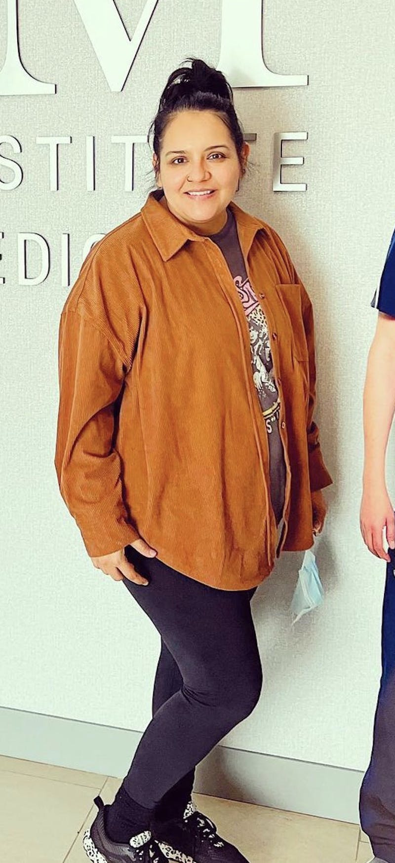 Patients 20-39 Years Old Before & After Gallery - Patient 51538702 - Image 1