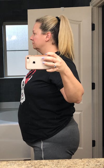 Patients 40-59 Years Old Before & After Gallery - Patient 55280931 - Image 1