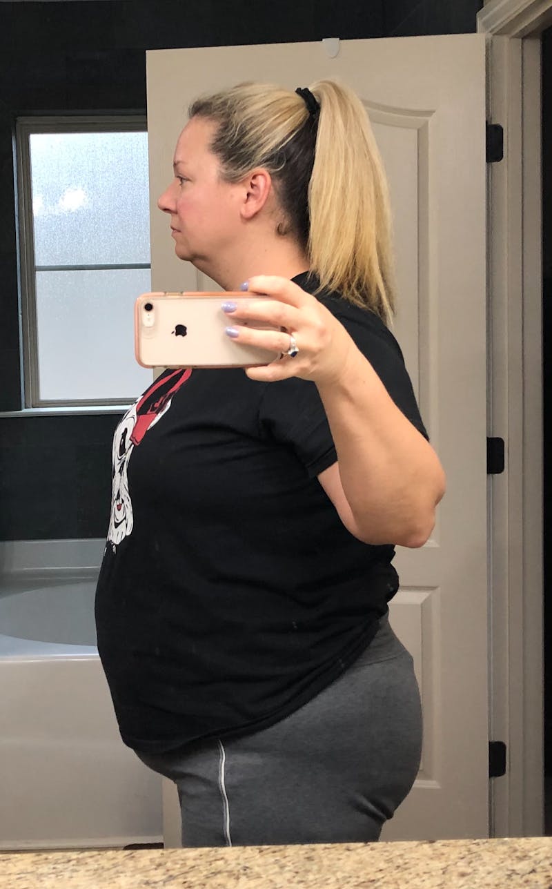 Patients 40-59 Years Old Before & After Gallery - Patient 55280931 - Image 1