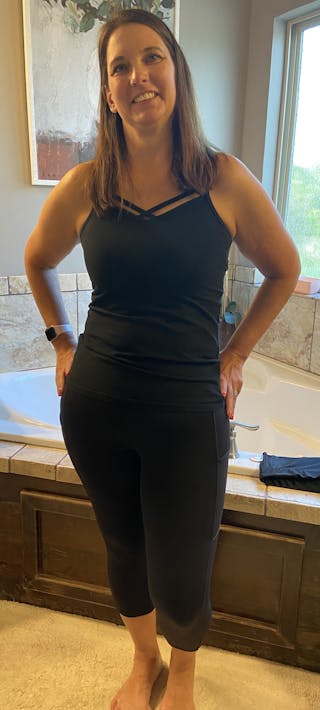 Patients 40-59 Years Old Before & After Gallery - Patient 55366402 - Image 2