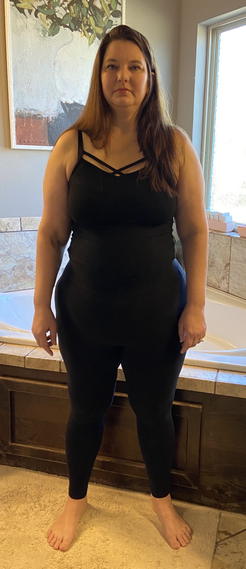 Patients 40-59 Years Old Before & After Gallery - Patient 55366402 - Image 1