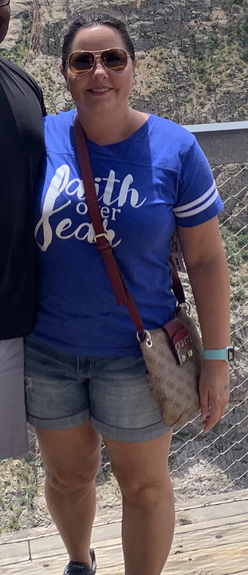 Patients 40-59 Years Old Before & After Gallery - Patient 55432377 - Image 1