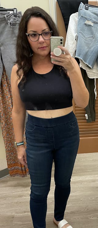 Patients 40-59 Years Old Before & After Gallery - Patient 55432377 - Image 2