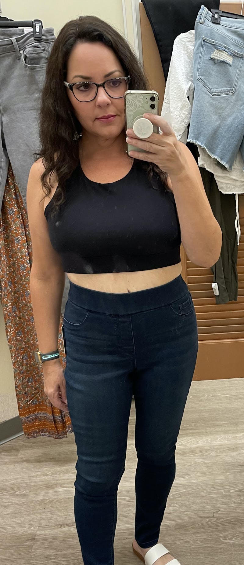 Patients 40-59 Years Old Before & After Gallery - Patient 55432377 - Image 2