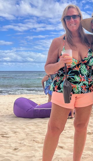 Patients 40-59 Years Old Before & After Gallery - Patient 55480018 - Image 2