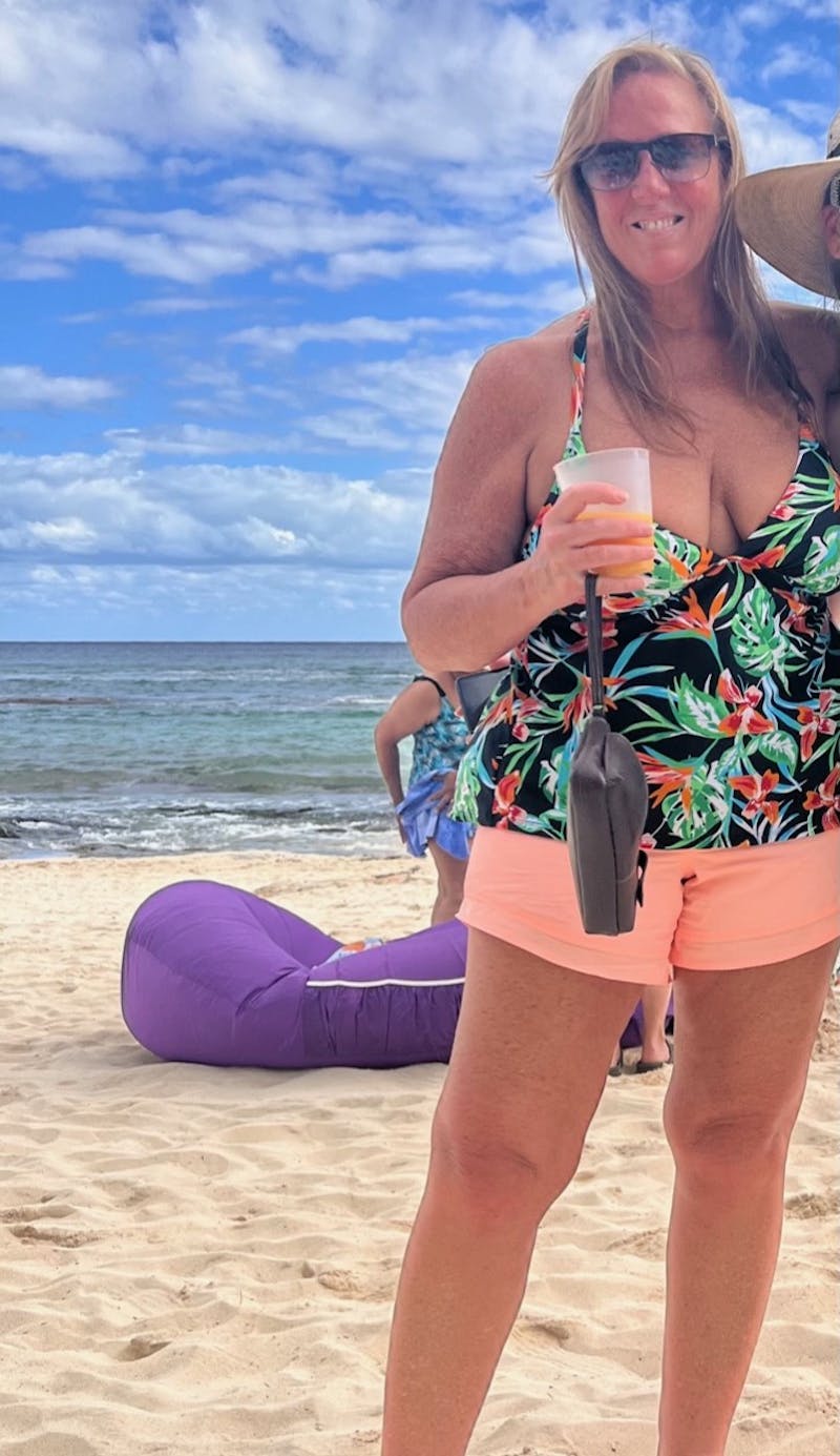 Patients 40-59 Years Old Before & After Gallery - Patient 55480018 - Image 2