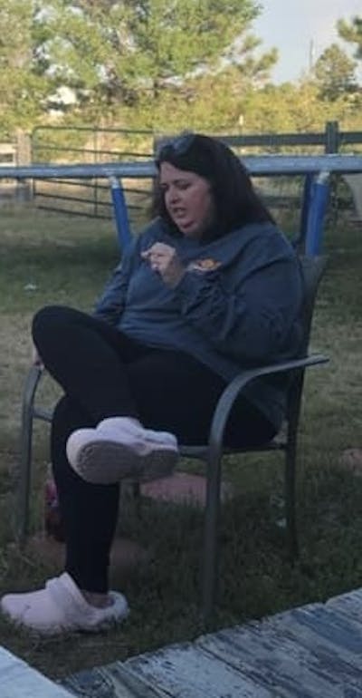 Patients 20-39 Years Old Before & After Gallery - Patient 55480017 - Image 1