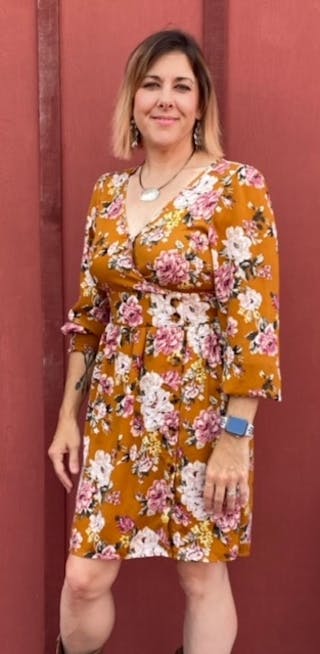 Patients 40-59 Years Old Before & After Gallery - Patient 55486087 - Image 2