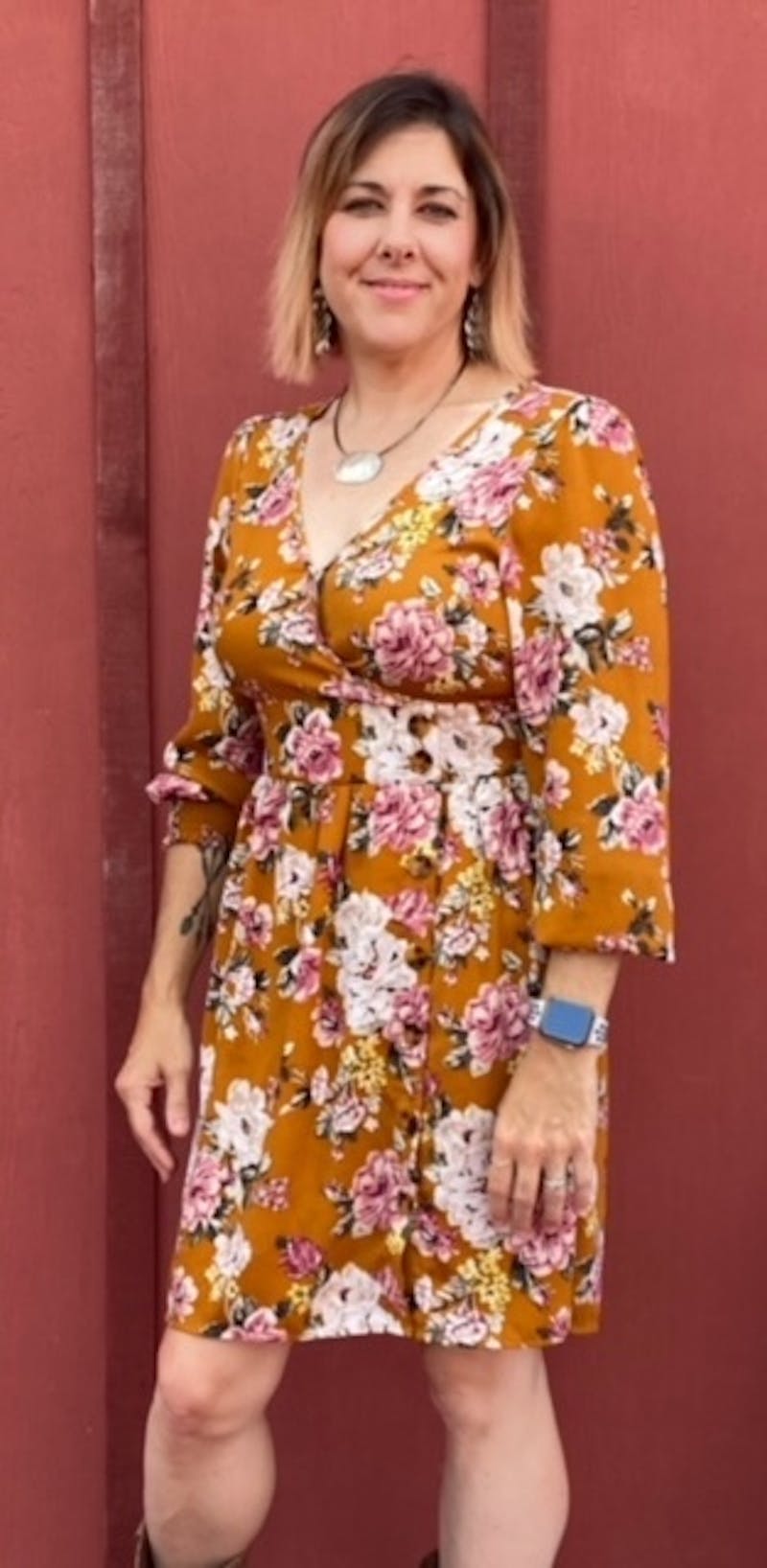 Patients 40-59 Years Old Before & After Gallery - Patient 55486087 - Image 2