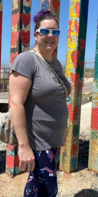 Patients 40-59 Years Old Before & After Gallery - Patient 55486087 - Image 1