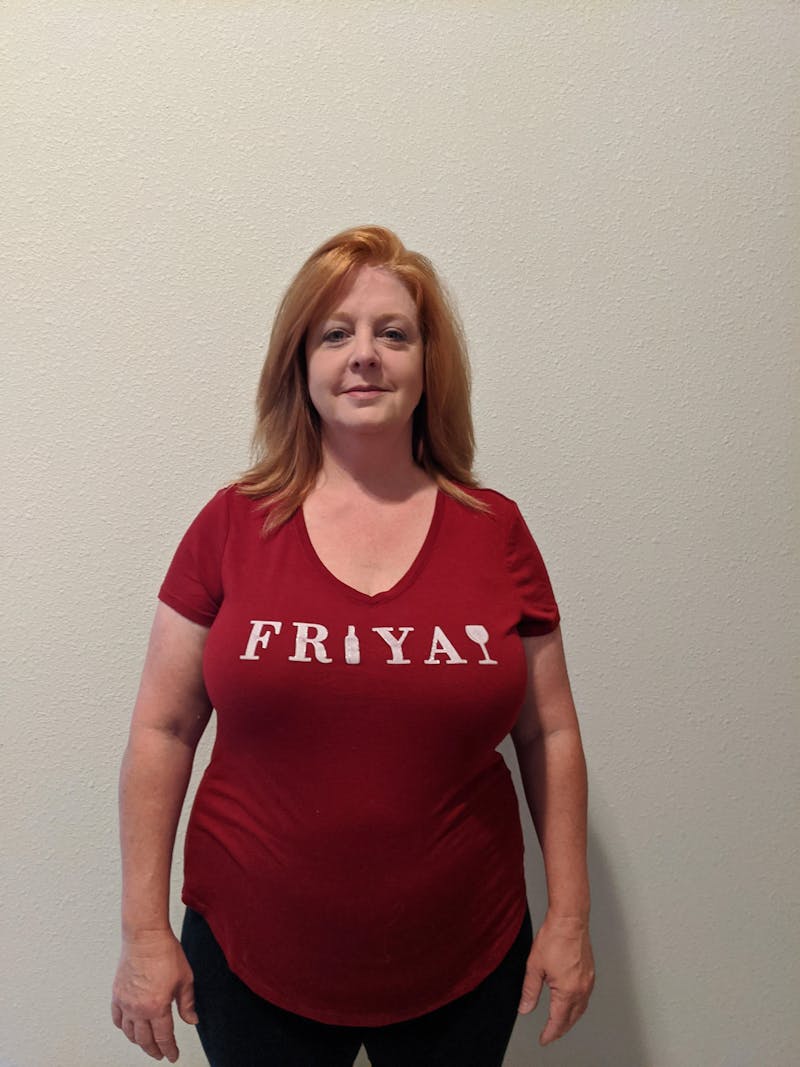 Patients 40-59 Years Old Before & After Gallery - Patient 55649668 - Image 1