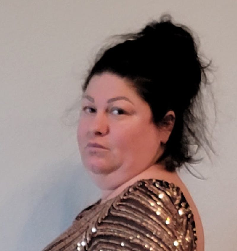 Patients 20-39 Years Old Before & After Gallery - Patient 55649673 - Image 1