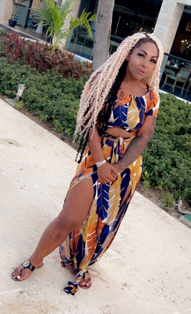 Patients 20-39 Years Old Before & After Gallery - Patient 55649676 - Image 2