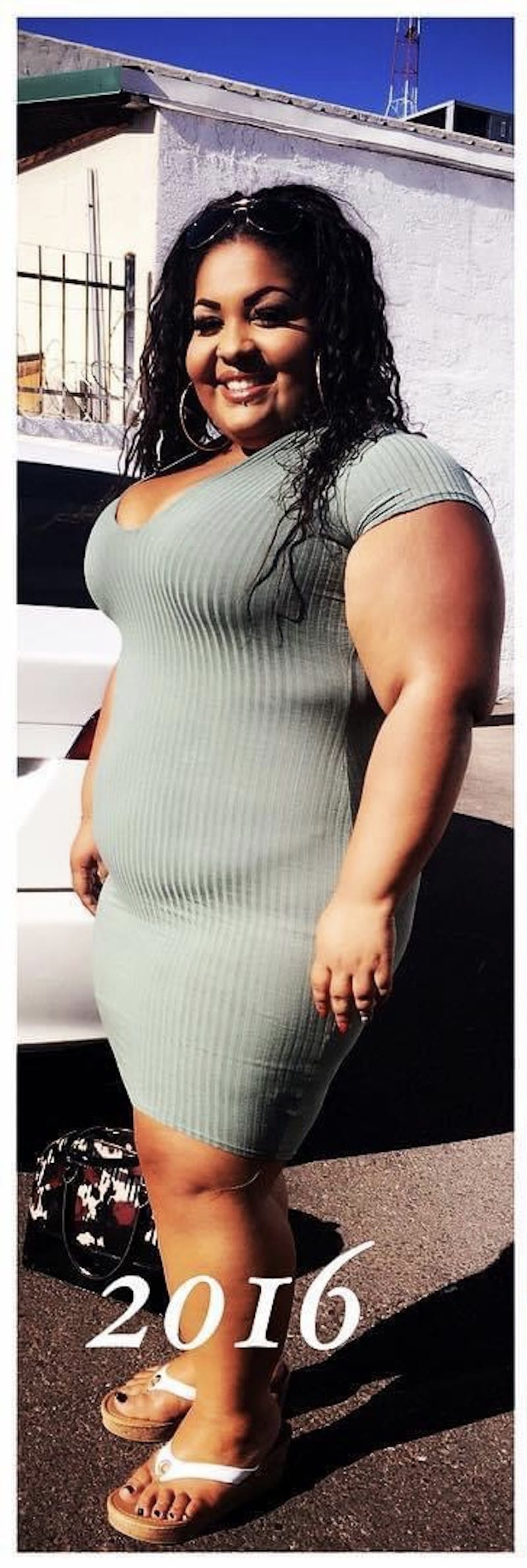 Patients 20-39 Years Old Before & After Gallery - Patient 55649676 - Image 1