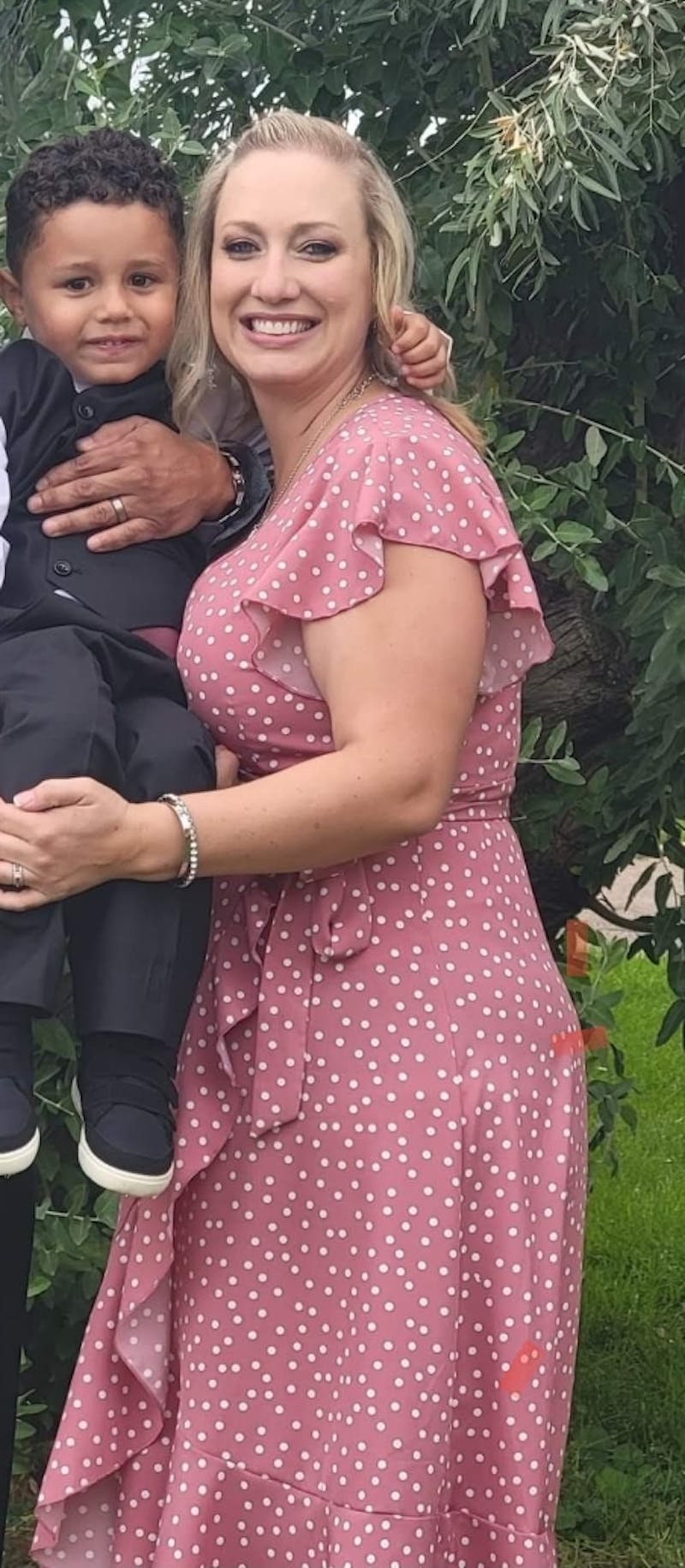 Patients 20-39 Years Old Before & After Gallery - Patient 55656998 - Image 2