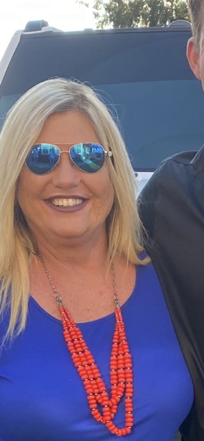 Patients 40-59 Years Old Before & After Gallery - Patient 55729293 - Image 1