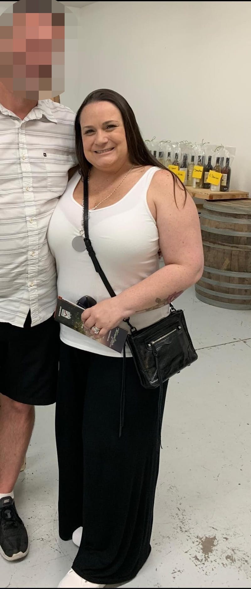 Patients 40-59 Years Old Before & After Gallery - Patient 55729294 - Image 1