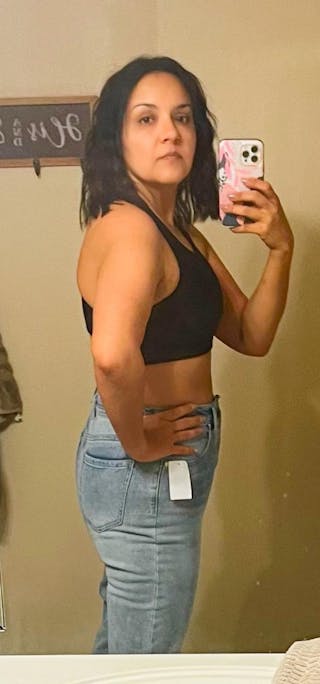 Patients 20-39 Years Old Before & After Gallery - Patient 55729295 - Image 2